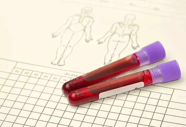 Blood vial with blood sample on record form — Stock Photo, Image