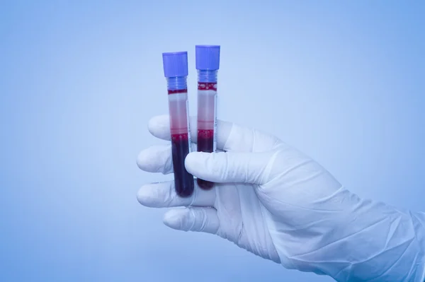 Mano del científico tomando un tubo de muestra de sangre — Foto de Stock