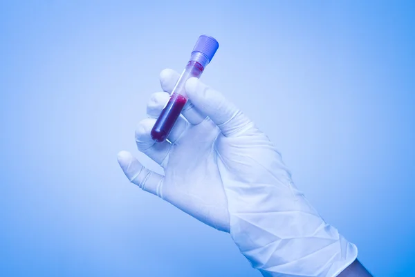 Hand of scientist  taking a blood sample tube — Stock Photo, Image