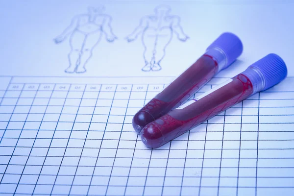 Blood vial with blood sample on record form — Stock Photo, Image