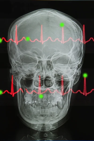 Image radiographique du crâne et ligne de vie de l'électrocardiogramme — Photo