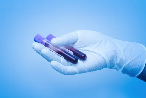 Mano del científico tomando un tubo de muestra de sangre — Foto de Stock