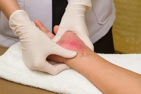 Paciente recibiendo un masaje de terapia en la cicatriz Imágenes De Stock Sin Royalties Gratis