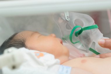 Oksijen maskesi, oksijen maskesi yapımı inhalasyon hastada bebek