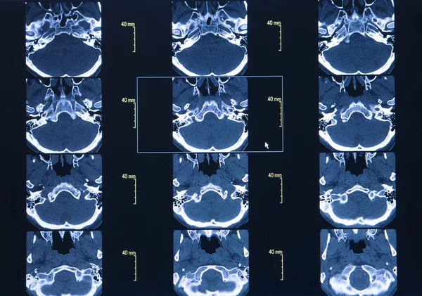 CT scan hrudní segmentu. Věda pozadí — Stock fotografie