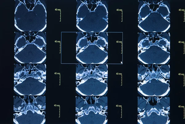 CT scan hrudní segmentu. Věda pozadí — Stock fotografie