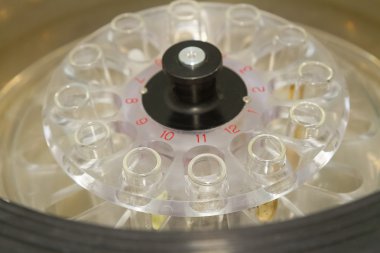 Santrifüj kan ve idrar testi