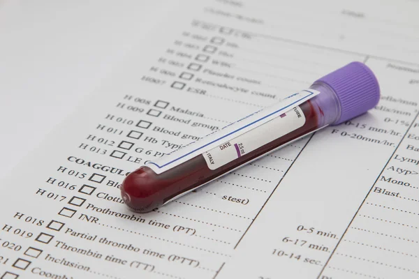 A bottle of blood sample on medical report — Stockfoto