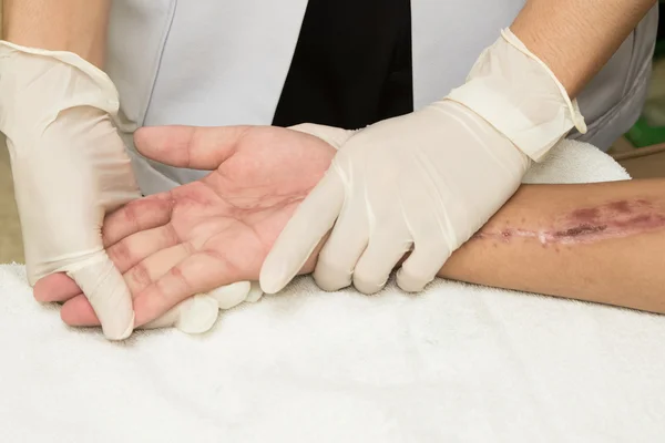 Physiotherapeut macht Handübungen nach Verletzung der Hand — Stockfoto