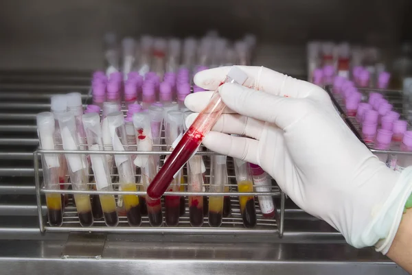 Técnico de laboratório segurando teste de tubo de sangue em fundo banco de sangue — Fotografia de Stock