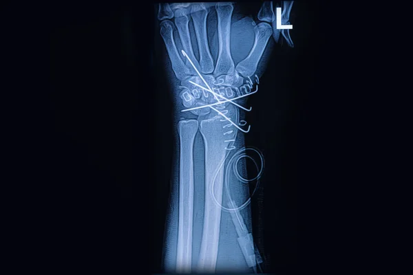 Á Letter K Tattoo On Wrist Stock Photos Royalty Free K Wire Images Download On Depositphotos