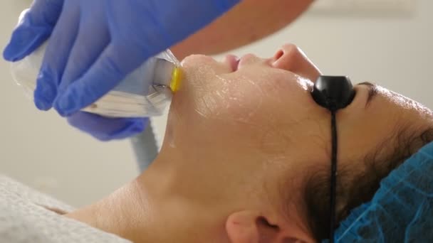 Lifting non chirurgico nel salone di bellezza. cosmetologia della macchina. Il dispositivo di lifting facciale fa lampi. Ristrutturazione facciale. Primo piano colpo di donna in occhiali protettivi ottenere procedura di bellezza. 4 k — Video Stock