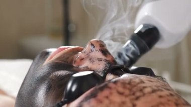 Güzellik uzmanı eski deriyi karbon fiber katmanla temizler. Alnındaki bölge inceleniyor. Karbon soyma. Kozmetik uzmanı karbon yüz soyma prosedürü yapıyor. Donanım kozmetolojisi. 4k video