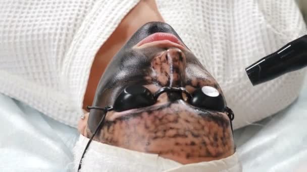 Cosmetólogo haciendo procedimiento de peeling de cara de carbono. El láser pulsa la piel limpia de la cara. Tratamiento cosmetológico de hardware. Proceso de pelado láser. Rejuvenecimiento facial de la piel. 4 k vídeo — Vídeos de Stock