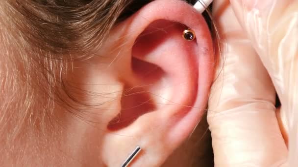 En söt tonårstjej med hål i öronen. Kvinnlig patient som får öron genomborrade av kosmetolog. Läkare debridering sår i brosk i örat med grädde. Fullständig hd — Stockvideo