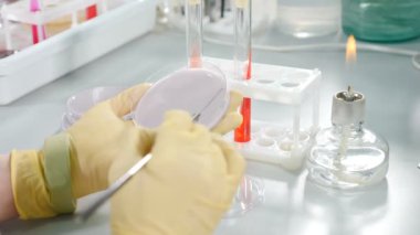 Mikrobiyoloji Laboratuvarı: Bilim adamı Petri Tabakları ile Çeşitli Bakteriler, Antibiyotikler için İlaç Araştırmaları, Petri kabında mikroorganizmalarla çalışan laboratuvar asistanı. Bakteri ekiyorum. 4 bin.