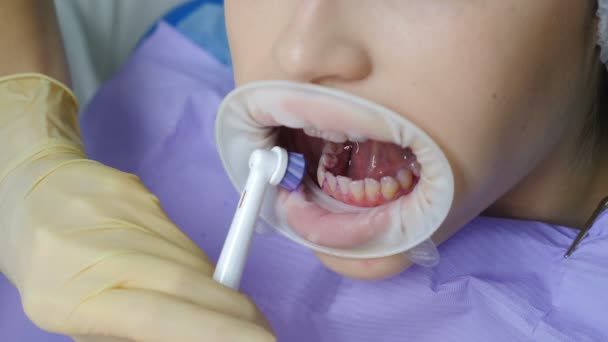 Clinique dentaire moderne. Hygiène buccale et nettoyage prophylactique. Patiente lors d'une procédure hygiénique de nettoyage des dents en dentisterie. Médecin brossant les dents dans le cadre du traitement. Vidéo 4 k — Video