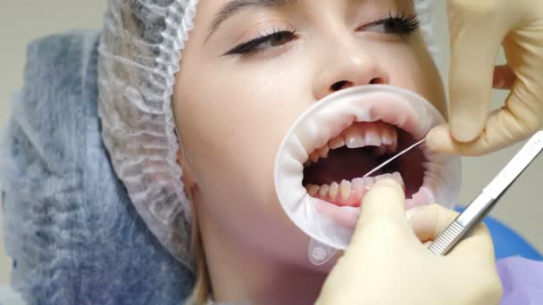 Higiene oral e limpeza profilática. Clínica dentária moderna. Paciente feminina no procedimento de limpeza de dentes higiênicos em odontologia. Doutor lava os dentes com água e enfermeira usando ejetor de saliva. 4 k vídeo — Vídeo de Stock