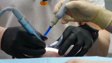 Tanımlanamayan erkek dişçi hastayı tedavi ediyor. Stomatoloji kök kanallarını tedavi ediyor. Diş matkabı, sondaj makinesi, doktorların elindeki profesyonel aletler. Diş sağlığı konsepti. 4 k video