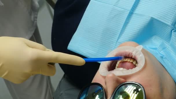 Clínica dentária moderna. Ortodontista preparando a mandíbula para coroação dentária ou instalação de folheados, dentes de secagem assistente com ferramenta especial. Conceito de saúde e medicina. 4 k vídeo — Vídeo de Stock