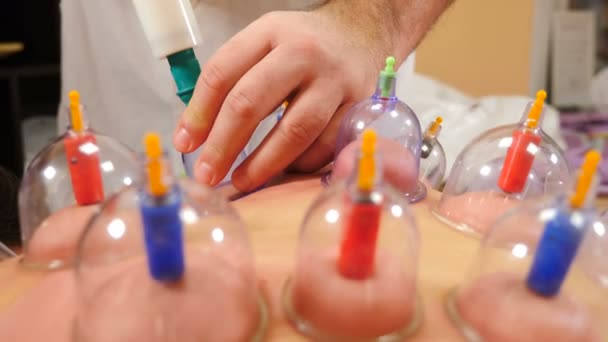 Cupping proces. Hidžamové poháry na zádech pacientky v akupunkturní terapii. Tradiční čínské zacházení. Lékařské vybavení na přípravu šálků. Zdravotnický specialista provádí šálkovou techniku. 4 k — Stock video