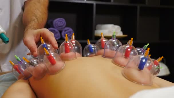 Kosmetisk kroppsmassage med cuppingglas. Massage Spa Therapy Behandling med glasburkar, akupunktur teknik. Kinesisk traditionell behandling. Medicinsk utrustning. 4 k video — Stockvideo