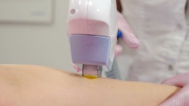 Güzellik uzmanı kollarında lazer tüyü çıkarıyor. İstenmeyen vücut kıllarını alıyorum. Güzellik prosedürü. Güzellik kliniğinde lazer epilasyonu. fotoepilasyon, vücut ve deri bakımı konsepti. 4 k video