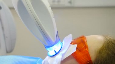 Modern diş kliniğinde profesyonel diş beyazlatma ya da beyazlatma prosedürü. LED beyazlarken koruyucu gözlüklü hasta. Ultraviyole ışınları. Diş minesi beyazlatma için lamba. 4K video