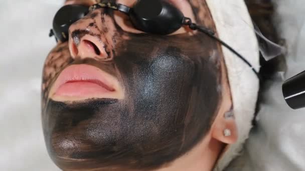 Cosmetólogo haciendo terapia de carbono procedimiento de peeling cara. Pulsos láser para limpiar la piel facial. Cosmetología de hardware. Proceso de fototermólisis, calentamiento de la piel, descamación láser. Rejuvenecimiento facial de la piel. 4. — Vídeos de Stock