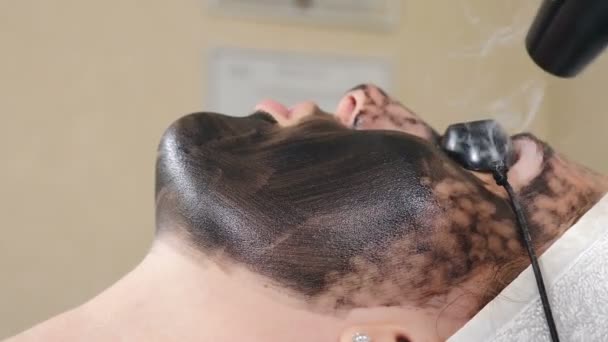 Cosmetoloog maakt koolstof therapie gezicht peeling procedure. Laser pulseert schone gezichtshuid. Hardware cosmetologie. Proces van fotothermolyse, warme huid, laserpeeling. Gezichtsverjonging. 4 — Stockvideo