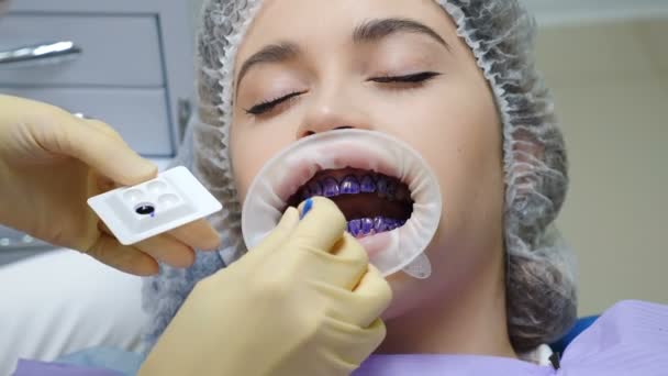 Práctica odontológica. Procedimiento de higiene dental. descamación dental profesional. Paciente femenina en silla dental en consultorio odontológico moderno. limpieza dental, higiene bucal y limpieza profiláctica. 4 k vídeo — Vídeos de Stock