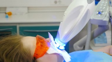 Diş beyazlatma prosedürü. Diş hekimi ultraviyole lamba kullanarak diş beyazlatıcısı yapıyor. Güzel ve mükemmel bir gülümseme. Modern dişçilik konsepti. LED beyazlarken koruyucu gözlüklü hasta. Morötesi
