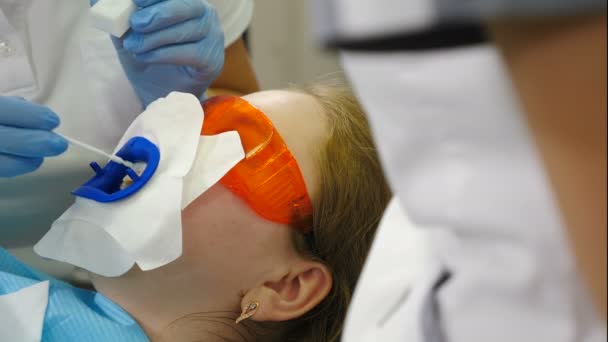 Team of doctors preparing female patient for teeth hitening isolating gums. Professional oral bleaching using ultraviolet lamp. Perfect smile with white teeth. Teeth whitening procedure. 4 k video — Stock Video