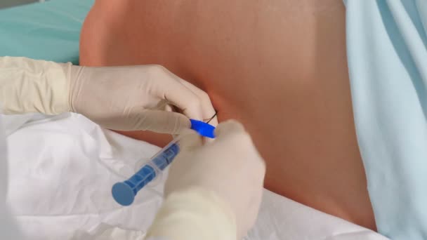 Injection d'anesthésie rachidienne, anesthésie épidurale ou bloc nerveux. Anesthésiste au travail. Anesthésiste ou médecin tenant une aiguille épidurale près du dos du patient, préparation à une césarienne ou — Video