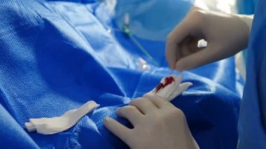 Endovasküler ameliyat prosedürü. Doktor ameliyattan önce vücudunda delik açıyor. Delinme yoluyla uygulanan cerrahi işlemin kapanışı. Ameliyathane, cerrah hastayı müdahale için hazırlıyor.