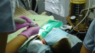 Modern diş kliniği. - Yakın çekim. Bir grup dişçi, çocuk anestezi altındayken cerrahi operasyon yaparken küçük çocuk dişçi koltuğunda uyuyakaldı. Hasta üzerinde istilacı işlemler