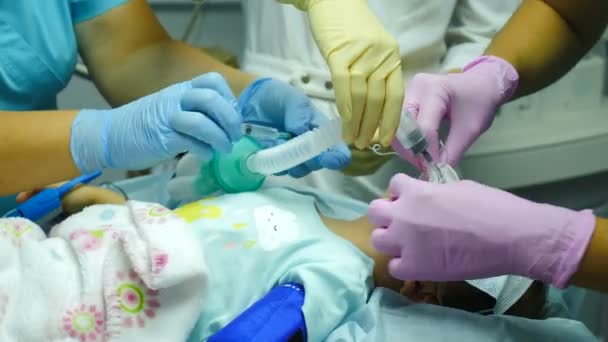 麻酔下の患者の子供,外科的治療を実行するために酸素マスクを持つ少女.医療用手袋の麻酔科医は、手術のための子供の患者を準備し、酸素マスクを調節します。医学の概念 — ストック動画