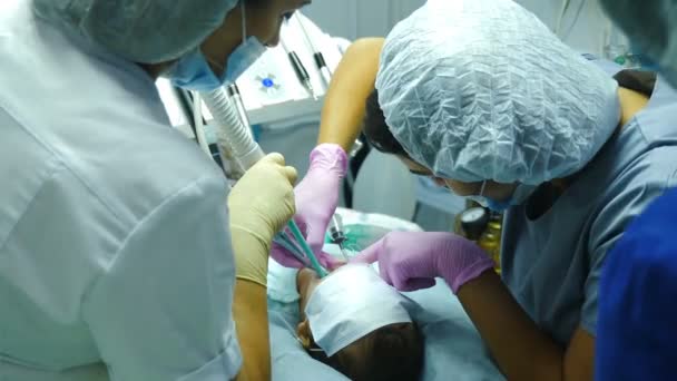 Tratamento dentário em criança sob anestesia geral. Médico dentista trata dentes de menina. Equipe de cirurgiões-dentistas profissionais que realizam operações invasivas no paciente com anestesia geral. 4 k — Vídeo de Stock