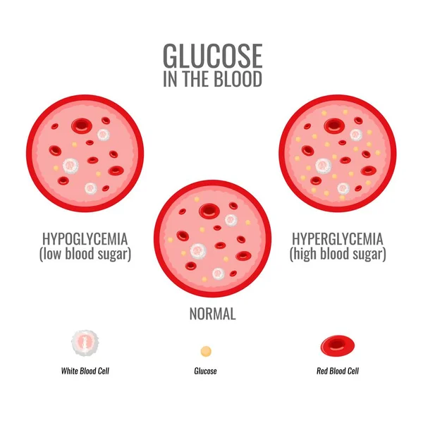 Glukosespiegel Infografik. Gefäß- und Blutgesundheit. Vektor — Stockvektor