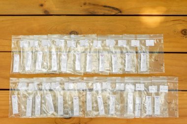 Posta poşetlerindeki Coronavirus (COVID-19) test sonuçlarının çoğu açık hava alanındaki ahşap masada düzenlenmiştir..