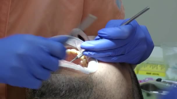 Dal Dentista Uomo Cura Denti Primo Piano — Video Stock