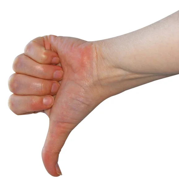 Αντίχειρας Κάτω Αρνητική Χειρονομία Που Απομονώνεται Λευκό Φόντο — Φωτογραφία Αρχείου
