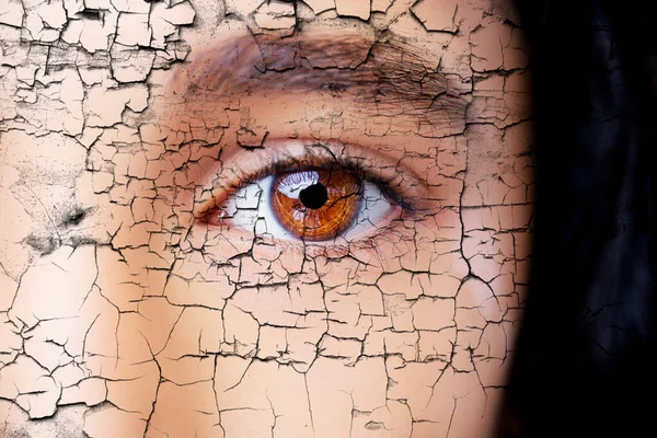 A beautiful insightful look eye with vitiligo. Close up shot — Stock Photo, Image