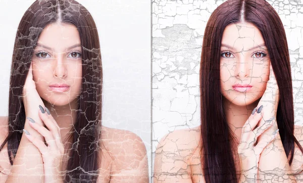 若い女性の前と後のレタッチ、美しさの治療。化粧品の前と後。抗年齢療法、にきびの除去、レタッチ. — ストック写真