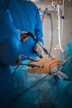 Rahmi çıkarmak için endoskopik ameliyat