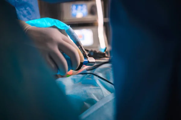 Rahmi çıkarmak için endoskopik ameliyat