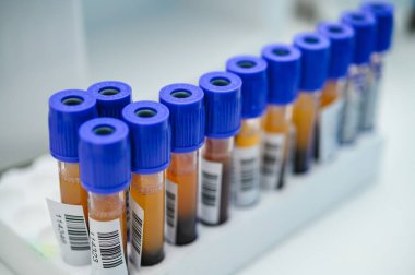 Raftaki test tüpleri. Laboratuvarda araştırma