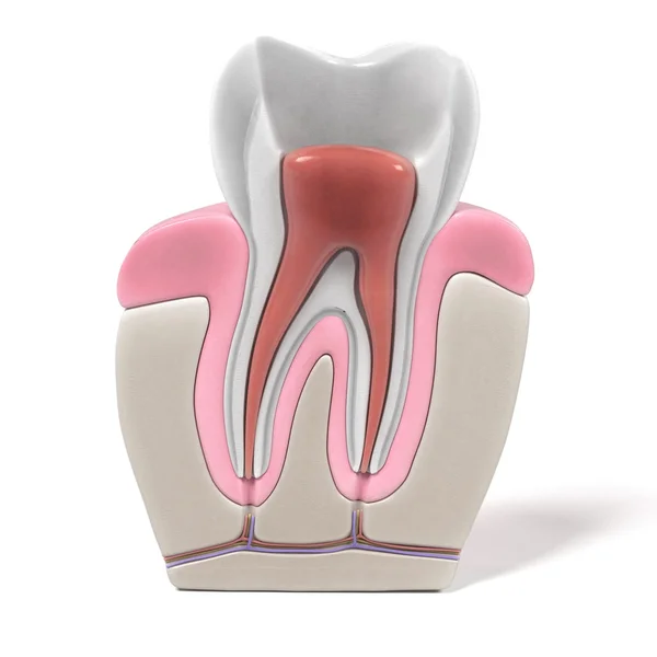 3D-renderingar av endodonti - rotfyllning förfarande — Stockfoto