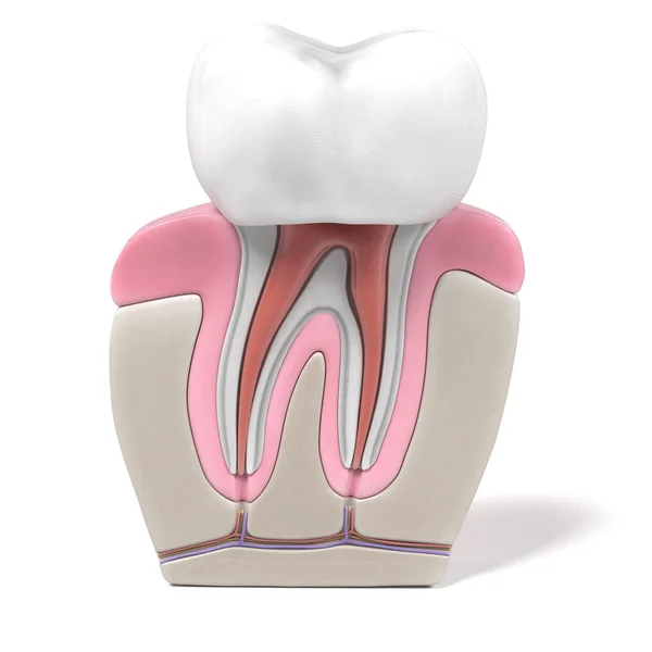 Endodontics - kanal prosedürü 3D render — Stok fotoğraf