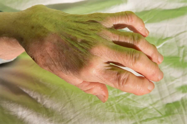 Hand van oude vrouw op het bed — Stockfoto
